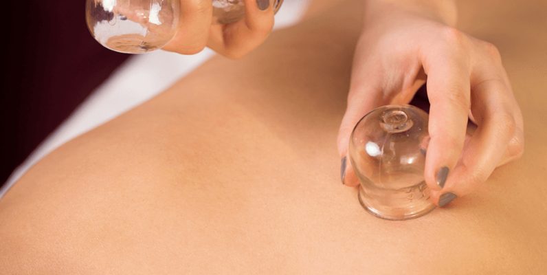 Cups op de rug tijdens een cuppingmassage
